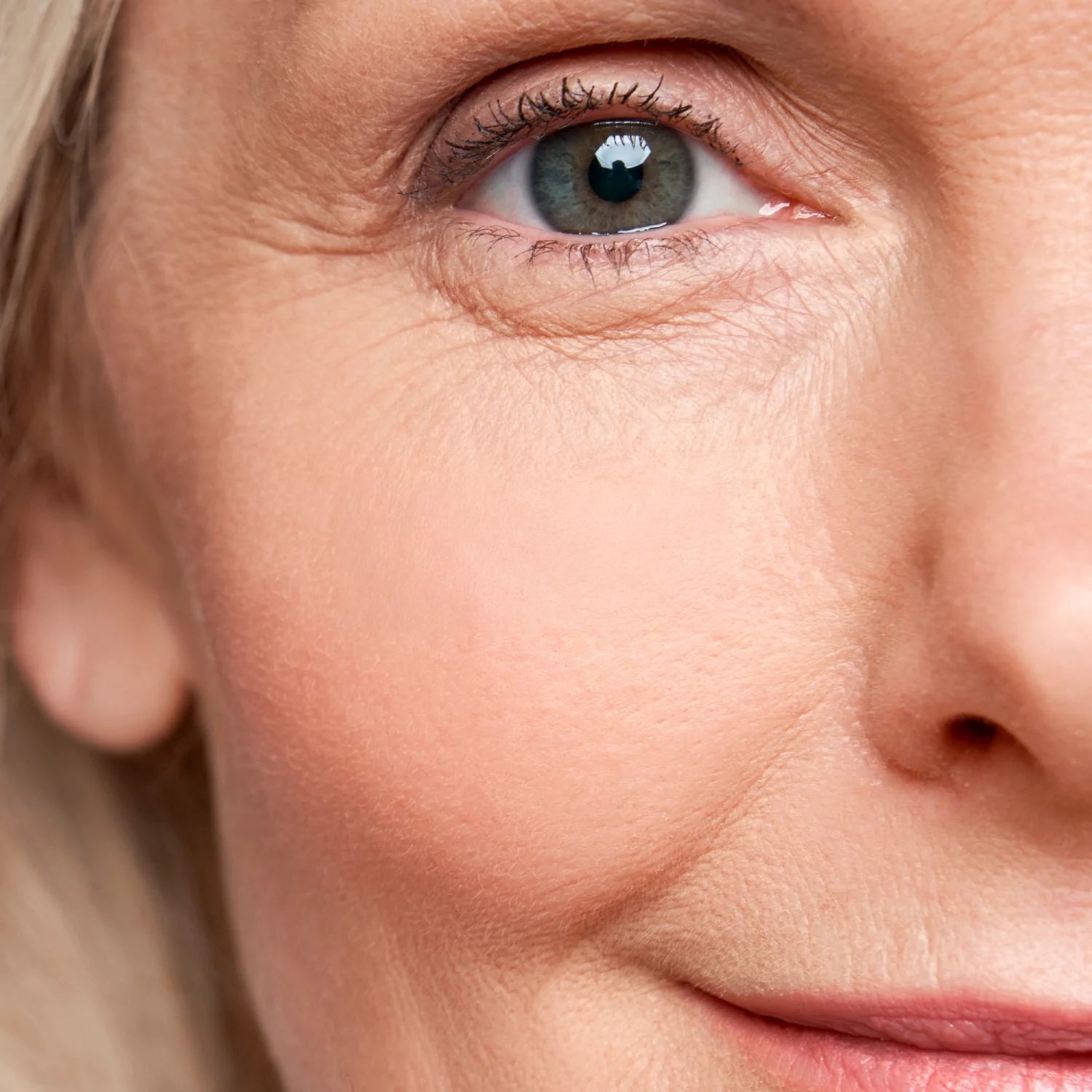 ¿Cómo Reducir Bolsas y Ojeras de Manera Efectiva? Descubre los Mejores Tratamientos
